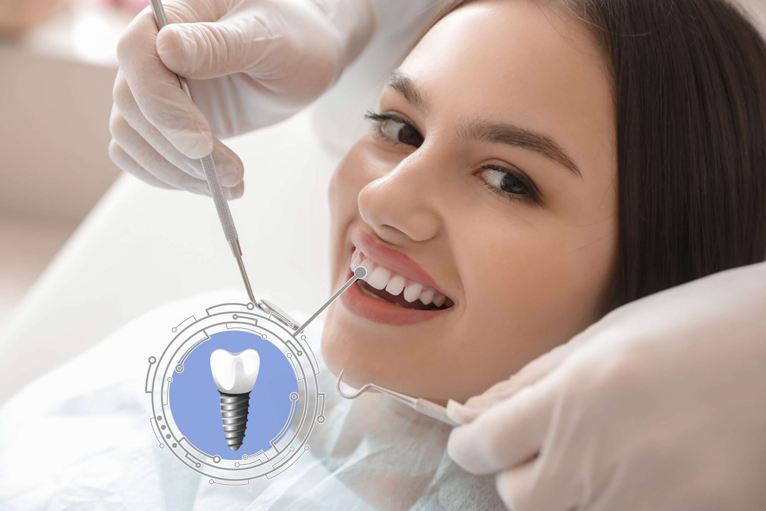 teeth whitening 2